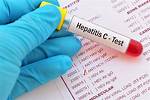 Is Hep C an Std?
