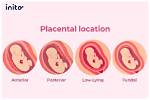 Is High Lying Placenta Normal?
