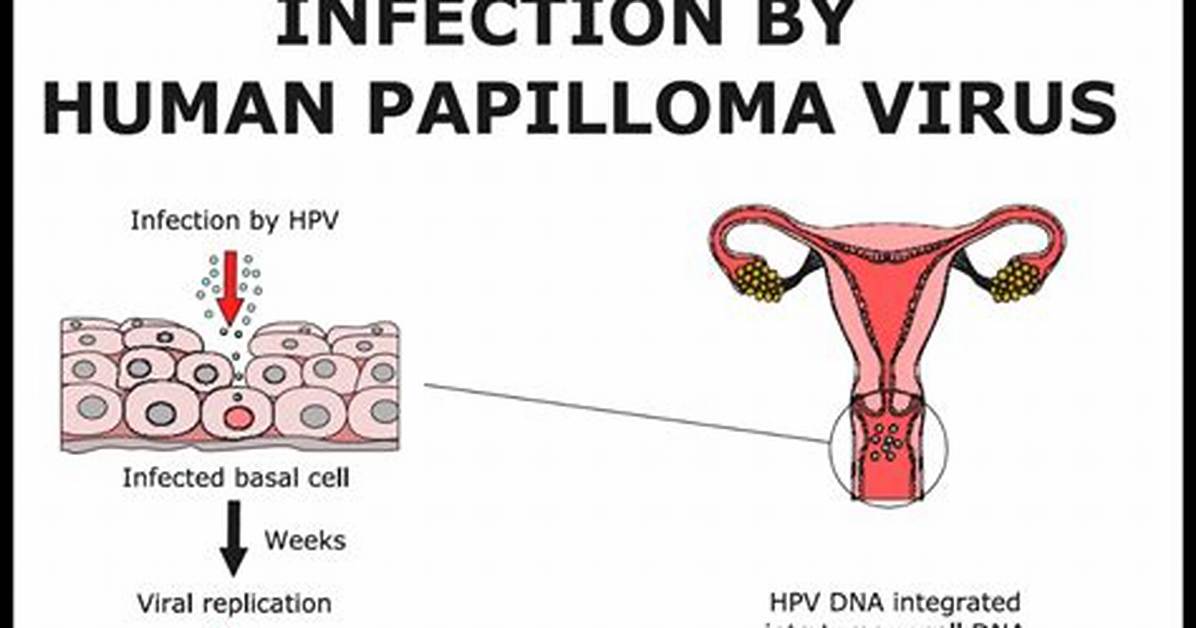 Is Hpv an Std
