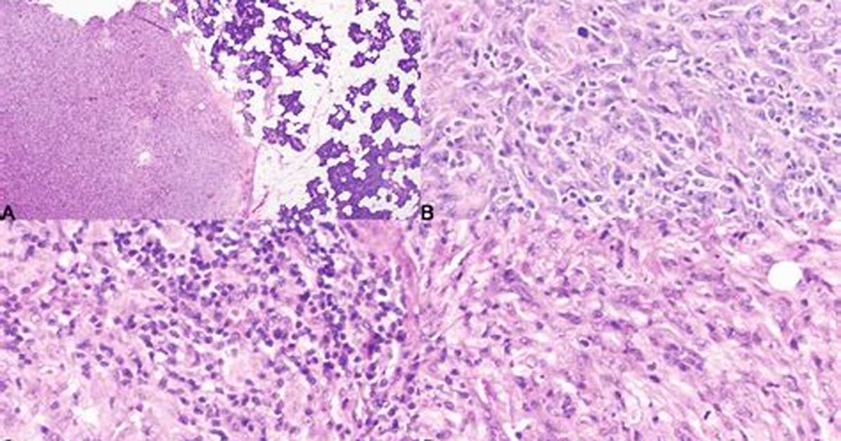 Is Interdigitating Dendritic Cells?