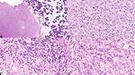 Is Interdigitating Dendritic Cells?