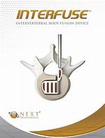Is Interfuse a Verb?