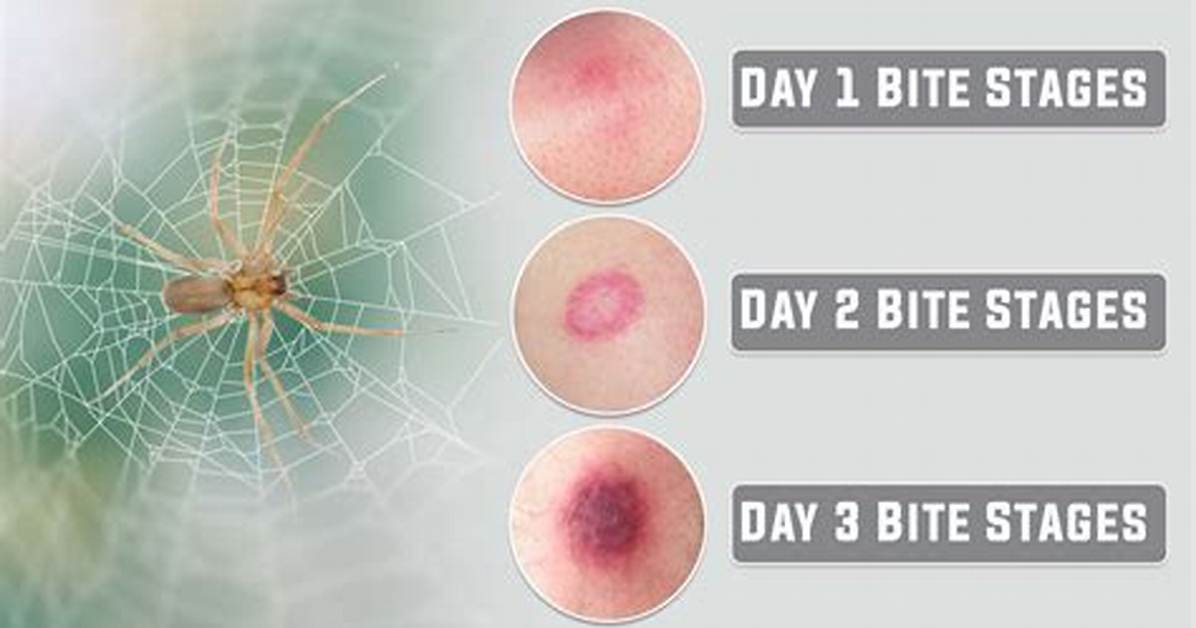 Is It a Spider Bite?