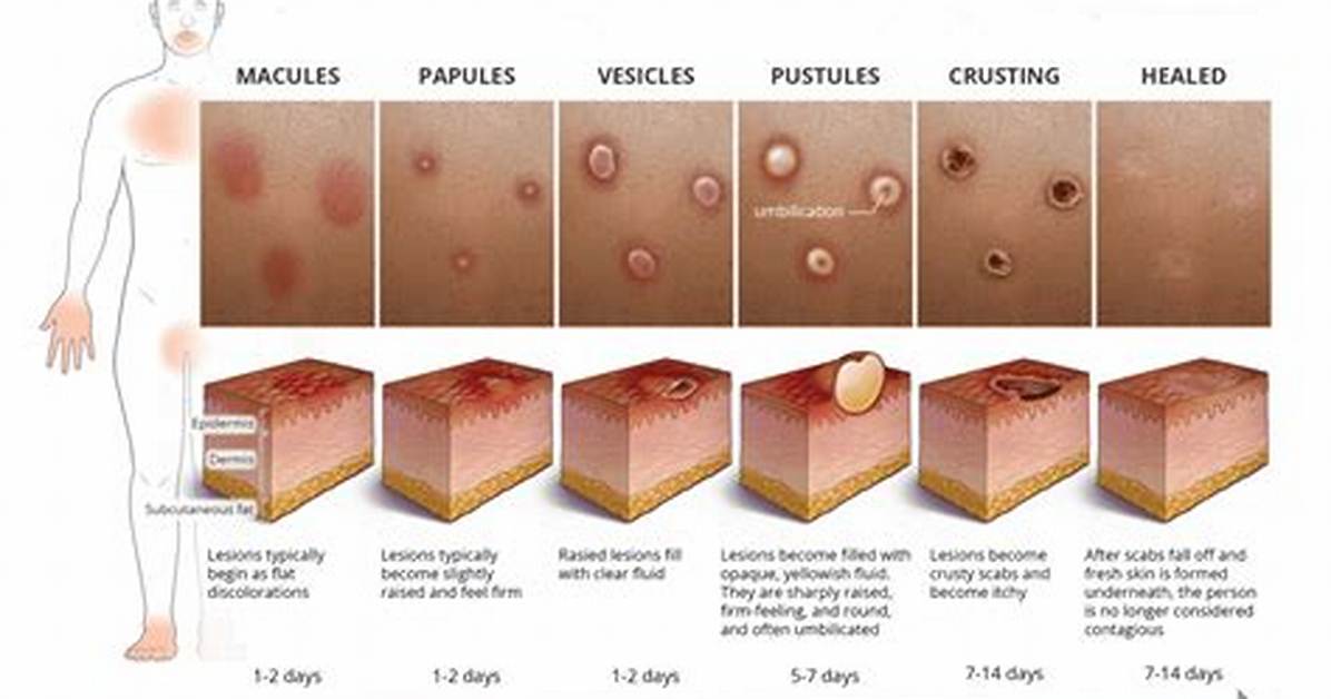 Is Lesions a Std?
