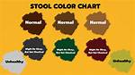 Is Light Brown Colored Stool Normal?