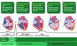 Is Occurring During Ventricular Ejection?