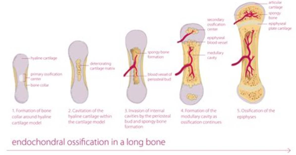Is Ossification a Bone Formation?