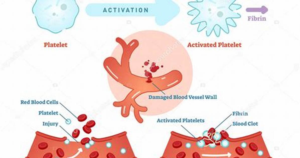 Is Platelets Decrease in Typhoid?