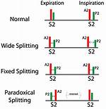 Is S2 Splitting Normal