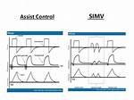 Is Simv Volume Control? | Contextresponse. Com