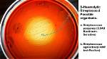 Is Streptococcus Beta Hemolytic?