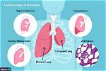Is Subsegmental Atelectasis Common?