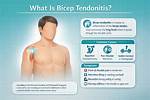 Is Tendonitis a Workers Comp?