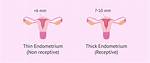 Is Thickened Endometrium Normal?