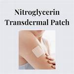 Is Transdermal Nitroglycerin Patch?