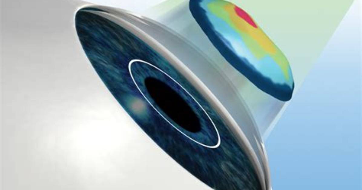 Is Wavefront the Same as Idesign?
