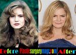 Jennifer Jason Leigh’s Plastic Surgery: Did She Really Go Under the Knife?
