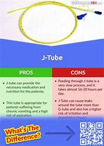 Jtube
