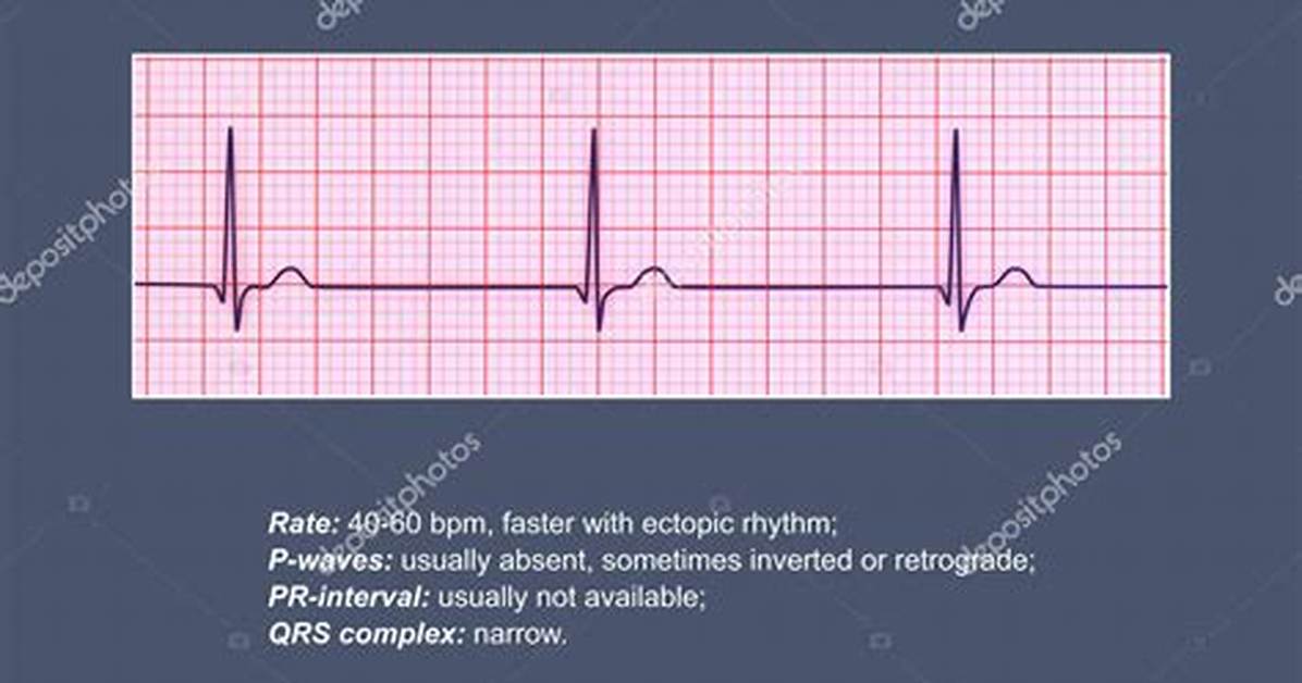 Junctional Rhythm