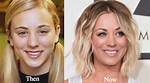 Kaley Cuoco Plastic Surgery: Cuoco's Steering Clear About Undergoing Procedures!