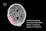 Karen Liu Ontario Accident: a Serious Injury for a Stantec Worker