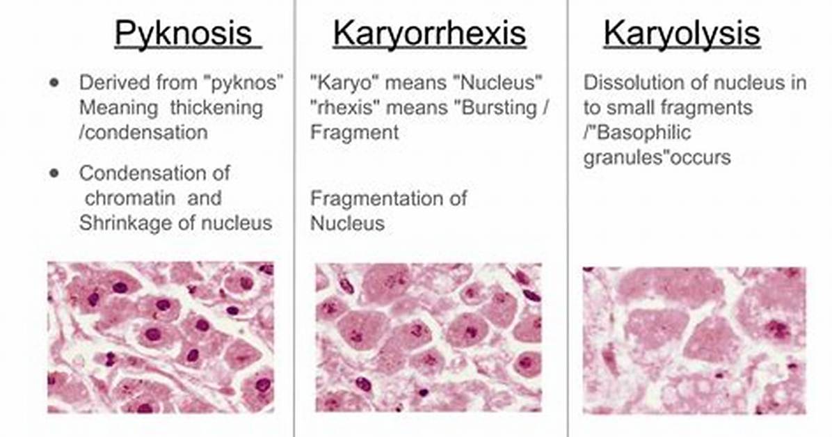Karyorrhexis