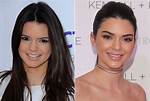 Kendall Jenner Opens up About Plastic Surgery: 'It Does Not Even Make Sense'