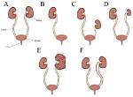 Kidney or Lima E. G.