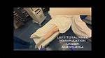 Knee Manipulation