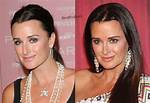 Kyle Richards Before Plastic Surgery: ‘Rhobh’ Star’ Stunning Look After Transformation