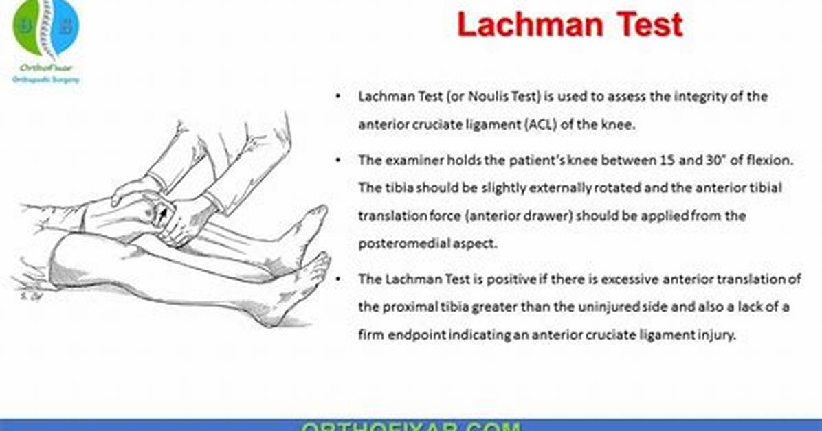 Lachmans Test