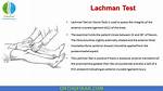 Lachmans Test