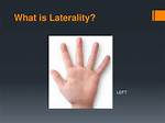 Laterality Meaning