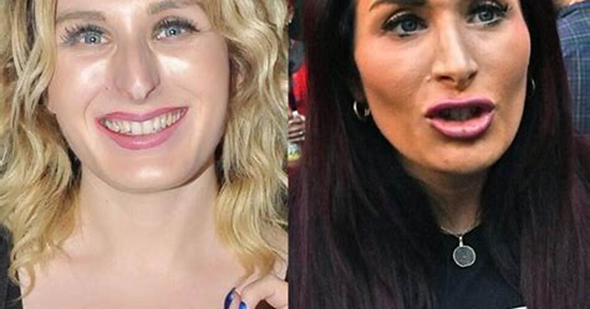 Laura Loomer Plastic Surgery: Exploring the Cause of Completely Different Appearance!