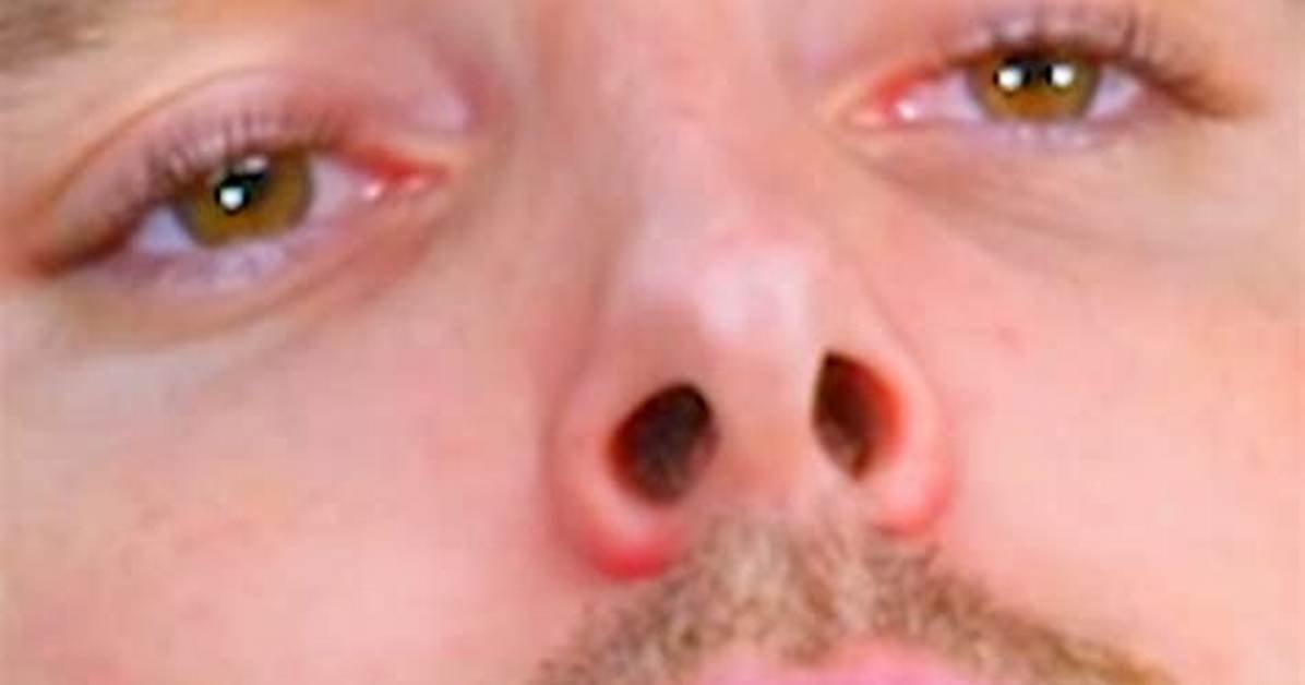 Lazarbeam