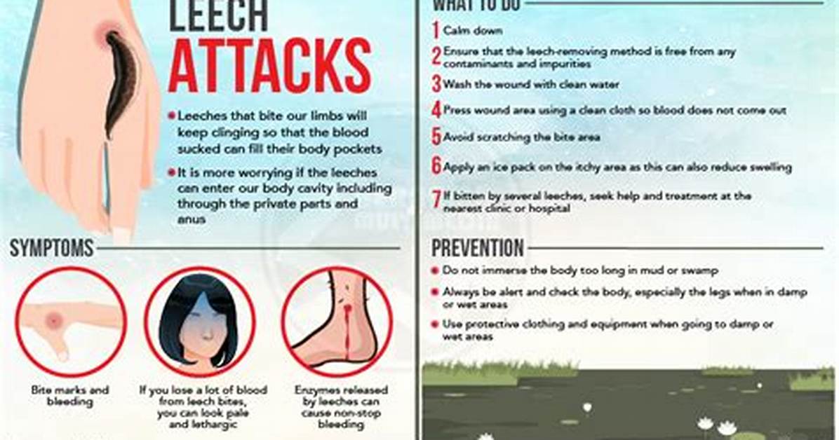 Leech Bites