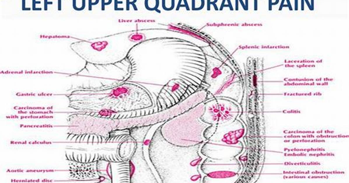Left Upper Quadrant