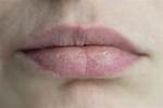 Like Chapped Lips