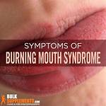 Lips Burning