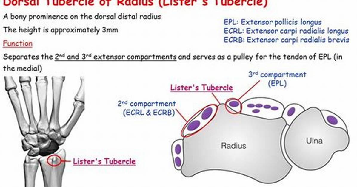 Listers Tubercle