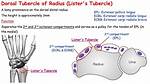 Listers Tubercle