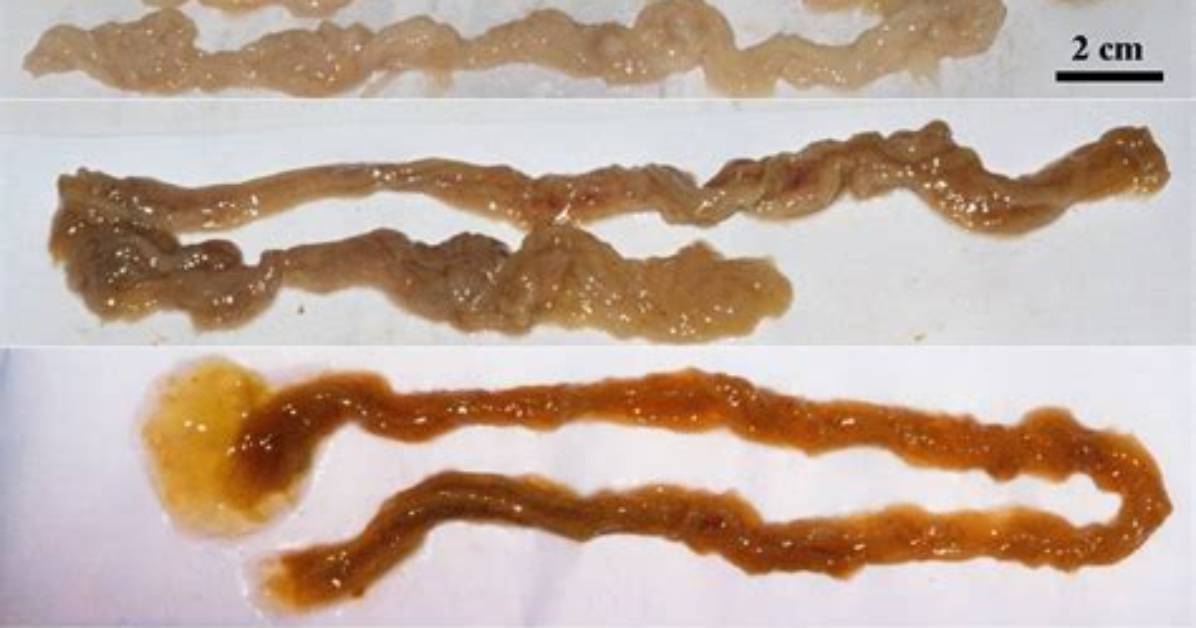 Long Stringy Poop