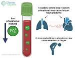 Low Phosphate Levels