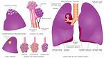 Lung Bleb