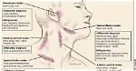 Lymph Nodes Collar Bone
