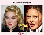 Madonna Plastic Surgery: from Fluffy Cheeks to Disappearing Dimples Everything That We Know!
