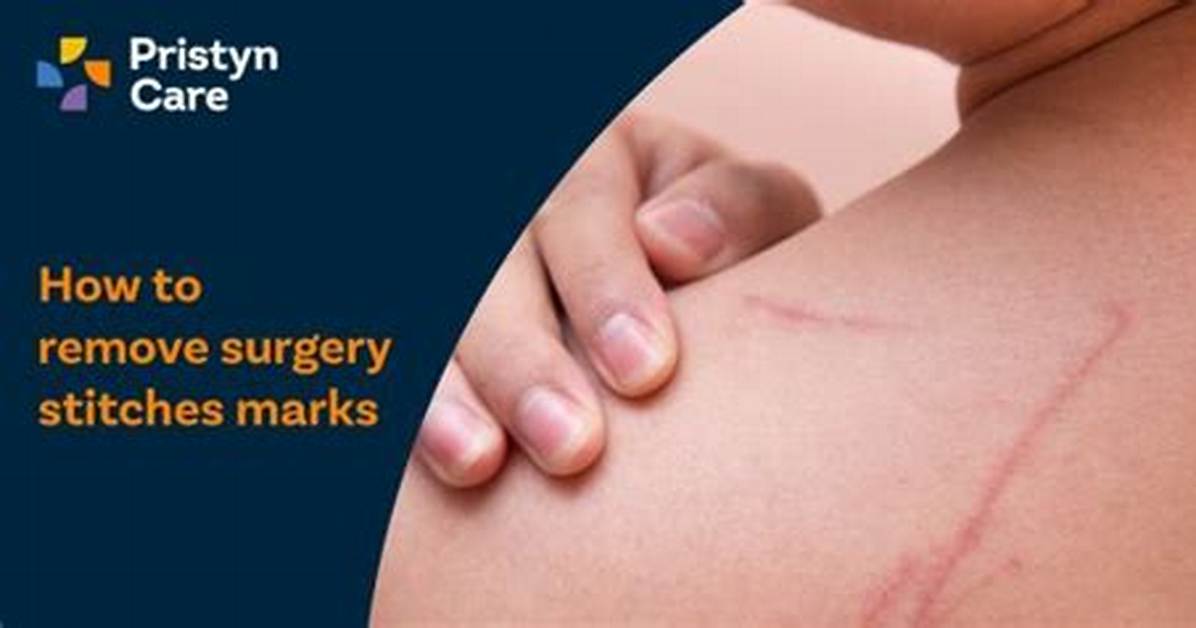 Mark Left After Surgery