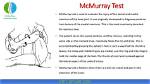 Mcmurray Test Knee