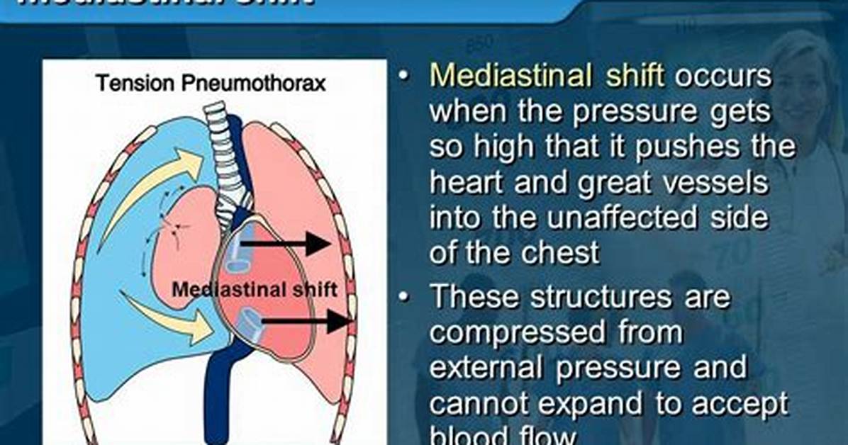 Mediastinal Shift