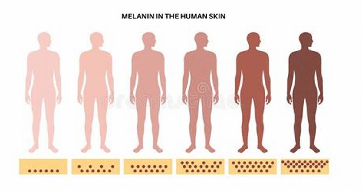 Melanism Human